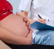 Sindromul Marfan la femeile gravide