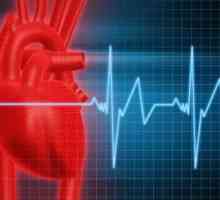 Tahicardie sinusală inima: tratament, simptome, cauze, simptome