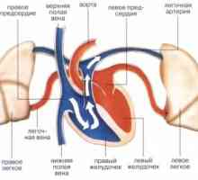 Emboliei sistemice: cauze, simptome, semne, tratament