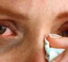 Ochi lăcrimare: tratament, cauze, simptome, semne