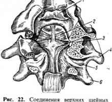 Un compus al coloanei vertebrale cu craniul