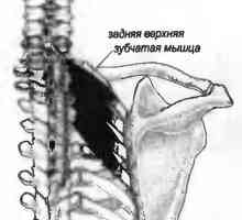 Durerile de spate cauzate de serratus