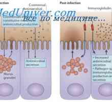 Structura imunoglobulinele membranei. Originea anticorpilor de suprafață