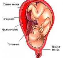 Sangerarea in primul trimestru de sarcină. De ce apar și dacă este normal?