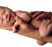 Livrare prematura si indicatii pentru cezariana in timpul sarcinii si la nastere ..