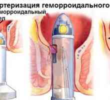 Transanal dezarterizatsiya hemoroizi interni