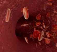 Transfuziile de sânge și produse din sânge la copii
