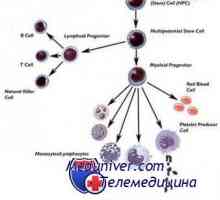 Transplantul de celule stem pentru acumularea de boli si talasemie