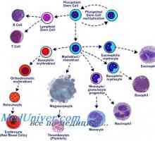 Transplantul de celule stem in bolile mieloproliferative mieloleykoze