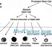 Transplantul de celule stem in siclemie, sindromul ventilator Diamond Black