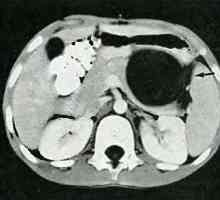 Trauma tractului urinar și a abdomenului. Pancreasul și duoden 12