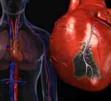 Leziuni traumatice ale inimii si vaselor de sange