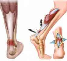 Leziuni traumatice și inflamații ale tendoanelor