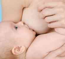 Fisurile niplului în timpul alăptării (alăptarea): tratament