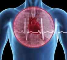 Embolism pulmonar și insuficiență cardiacă acută