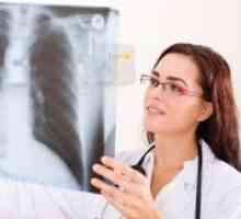 Tuberculoza pulmonară în timpul sarcinii, tratament, simptome, cauze