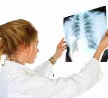 Tuberculoza ganglionilor limfatici periferici