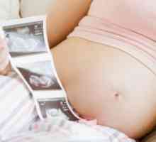 Pelvis îngust în timpul sarcinii