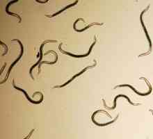 Tipuri și clasificarea nematodelor (viermi rotunzi) la om