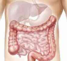 Tipuri de colită intestinală