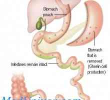 Influența hipotalamus și glanda pituitară în stomac. Efectele ACTH asupra stomacului
