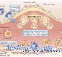 Efectul metabolismului lipidelor hipotalamic. Ateroscleroza la sindromul diencefalică