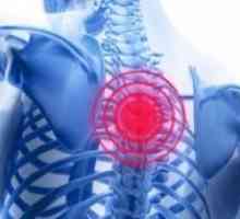 Tumori intracraniene și ale coloanei vertebrale