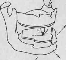 Înregistrare intraorala a mișcărilor mandibulei