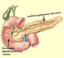 Inflamarea pancreasului pancreatita si cauzele sale, când și ce inflamate?
