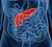Inflamație a pancreasului (pancreatită), semne și simptome, durere, temperatură