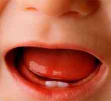 Febră mare și diaree în timp ce erupția dinților la copii