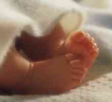 Boli ale copiilor imediat după naștere