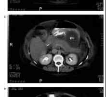 Boli pancreatice în timpul sarcinii: diagnostic