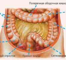 Boli ale intestinului subțire și mare a infecției cu HIV și SIDA