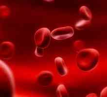 Zhelezorefrakternaya anemie