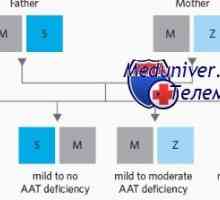 Copil Icter la deficit de alfa-1-antitripsină (a1-AM)