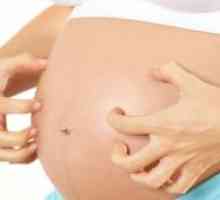 Mâncărimi ale pielii în timpul sarcinii în stadiile incipiente și ulterioare: cauze, tratament