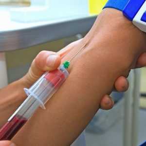 Testul de sange pentru anticorpi impotriva helmintice, antigene helmintice