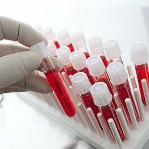 Analizele de sânge pentru opistorhoz (ifa, Biochimie), anticorpi (atm)