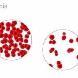 Anemia si pierderea de sange ascunse de la nivelul tractului gastro-intestinal