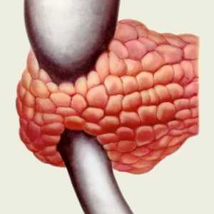 Anomalii ale pancreasului