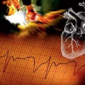 Insuficiența valvei aortice, tratamentul simptomelor