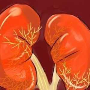 Autosomal boala rinichiului polichistic dominanta