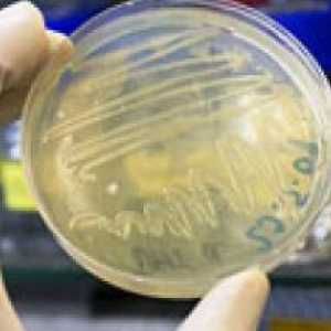 Analiza biochimică a suprainfectia bacterii fecale