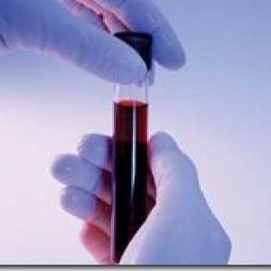 Analiza biochimică a sângelui