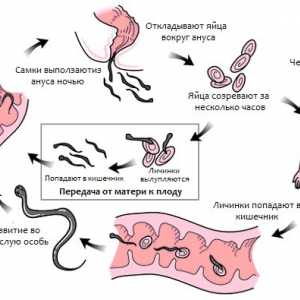 Infecție frecventă (vierme infestare) oxiurilor (enterobiazei) om