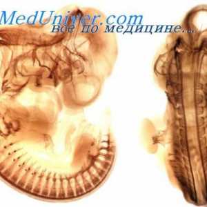 Nervi cranieni fetale. Dezvoltarea cranial nervilor Embrionul