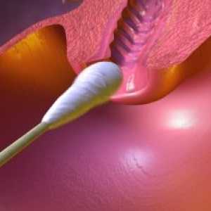 Examenul citologic al frotiului de col uterin