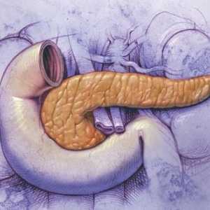 Fibroză Diffuse, modificări fibro gras ale pancreasului, simptome și tratament