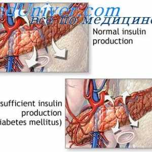 Efectul insulinei asupra metabolismului carbohidratilor. Schimbul de glucoză de către insulină